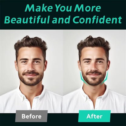 6-Piece Silicone Jaw Trainer Set – Facial Muscle Toner for Chin, Cheek & Neck, Includes Storage Box